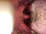 Проблемы в области слизистой рта и глотки фото 3