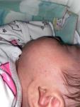 Сыпь у новорожденной фото 1