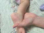 Сыпь на ступнях у ребенка фото 3