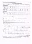 1. СССУ 2. Желудочковая тахикардия 3. тромбоэмболия 4. Параксизмальная тахикардия- неизвестно фото 4