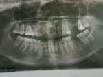 Непонятная боль в зубах фото 1