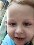 Фиолетовые синяки под глазами у ребёнка 2 лет фото 3