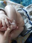 Образование на ноге у грудничка с рождения фото 3
