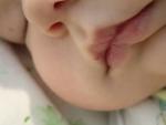 Покраснение губы у ребенка грудного возраста фото 1