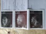 АМК репродуктивного периода фото 1