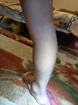 Вена на ноге у ребенка фото 2