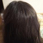 Перхоть или нет фото 2