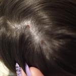 Перхоть или нет фото 3