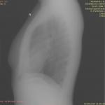 Рентген легких - результат по прилагаемому снимку фото 2