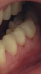 Проблемы с зубами фото 1