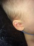 У ребёнка покраснело в ухе и за ухом фото 2