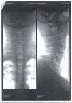 Помогите разобраться с диагнозом и рентгеном фото 2