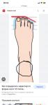 Онемение участка кожи на ноге фото 1
