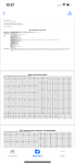 Расшифровка экг, экг с нагрузкой и ортостатической пробы фото 1