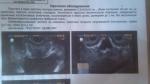 Результат спермограммы фото 4