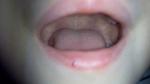 Красная точка на губе у ребенка фото 2