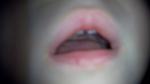 Красная точка на губе у ребенка фото 1