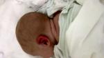 У ребенка после кормления в больнице смесью резко покраснело ухо фото 1