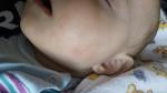 Красные сухие пятна на щеках у ребёнка фото 1