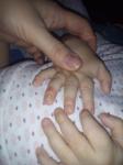 Красные пятна и рассыпающиеся ногти фото 4