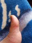 После подстригания ногтей, болит палец фото 1