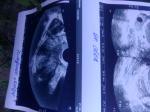 УЗИ ранний срок беременности фото 1