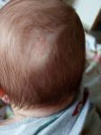 Лысое пятнышко на голове у малыша 2 мес фото 1