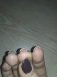 Водянистые пузырьки вокруг ногтя и на подушечках пальцев под ногтем фото 5