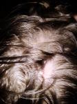 Выпадение волос у ребёнка фото 2