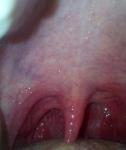 Болит горло месяц фото 1