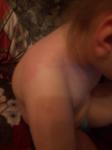 Красные, горячие пятна на теле у ребенка фото 2
