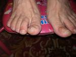 Проблема пальцав ног фото 2