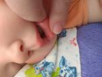Язвочки во рту у ребенка фото 1