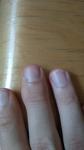 Странный вид ногтей фото 2