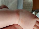 Красные шершавые пятна у трехмесячного ребенка фото 1