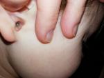 Боль и белый налет в ухе при орви фото 1