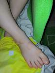 Странные пятна на ногах у ребенка фото 2