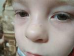 Черные точки на носу у ребенка фото 2