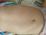 5дней температура, без сиптомов, легкая сыпь у ребенка 3 года фото 2