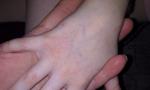 Сухая и шершавая кожа у дочки на руках фото 1