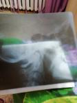 Результаты рентгена шейного отдела фото 6