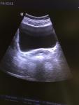 УЗИ на раннем сроке беременности, задержка 6 дней фото 2