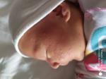 Новорожденный аллергия фото 1