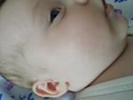 Сыпь на лице в 2 месяца фото 1