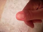 Белые пятна на ногтях и слоение фото 4