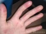 Почему облазит кожа на руках? фото 2