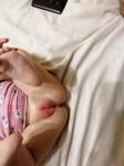 Аллергия на памперсы или крем у ребенка фото 1