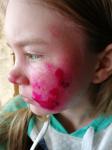 Аллергия на лице у ребёнка фото 2