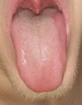Болит язык. Нужна помощь фото 1