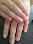 Лечение пальцев фото 1